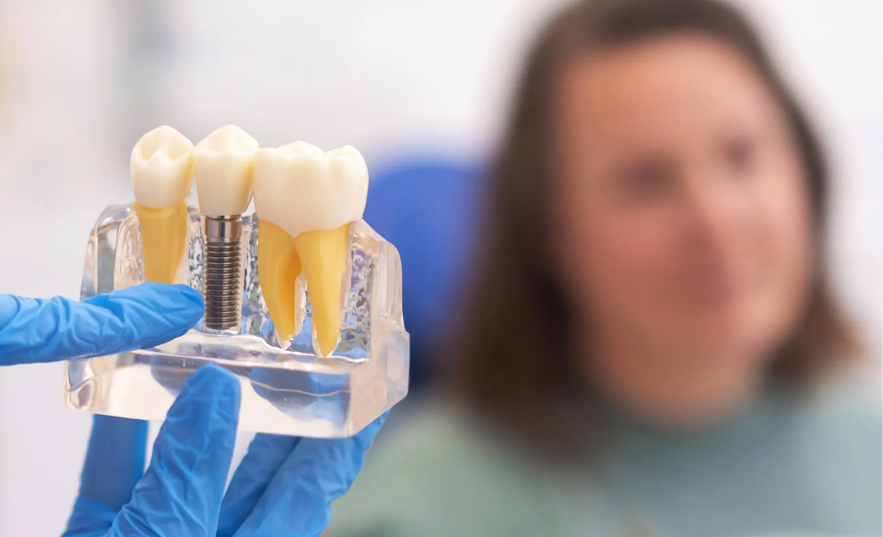 Имлантация Neodent + коронка